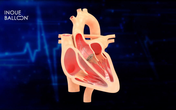 医療向け機器紹介動画（3DCG）